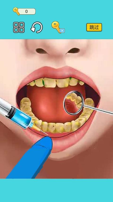高级牙医清洁游戏v1.0 1