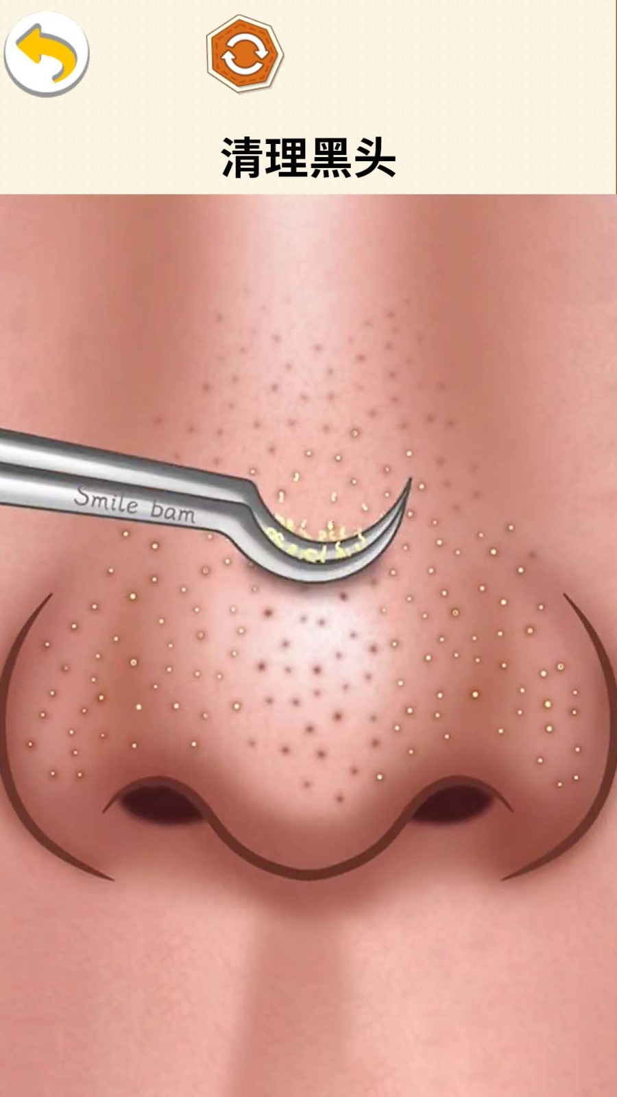 挤痘的乐趣游戏v1.0(2)