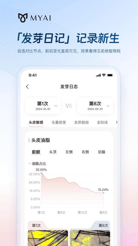 MYAI护发日记官方版