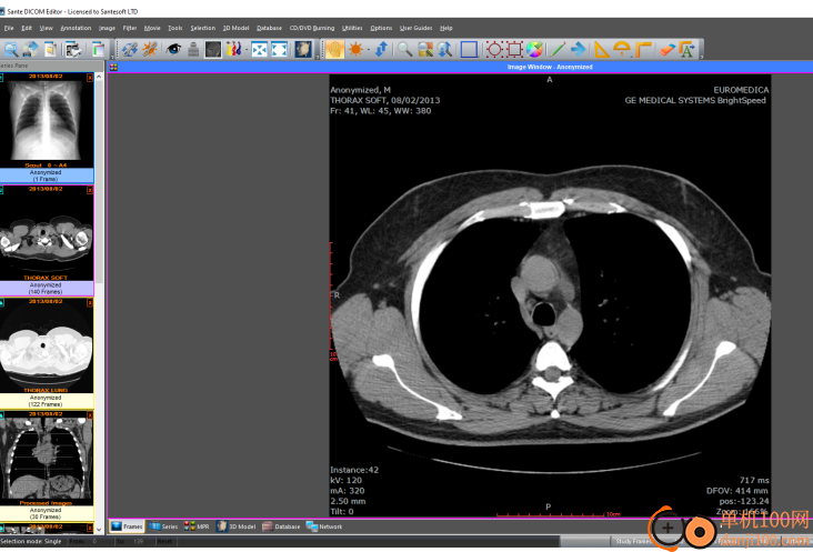 Sante DICOM Editor(医学影像编辑器)