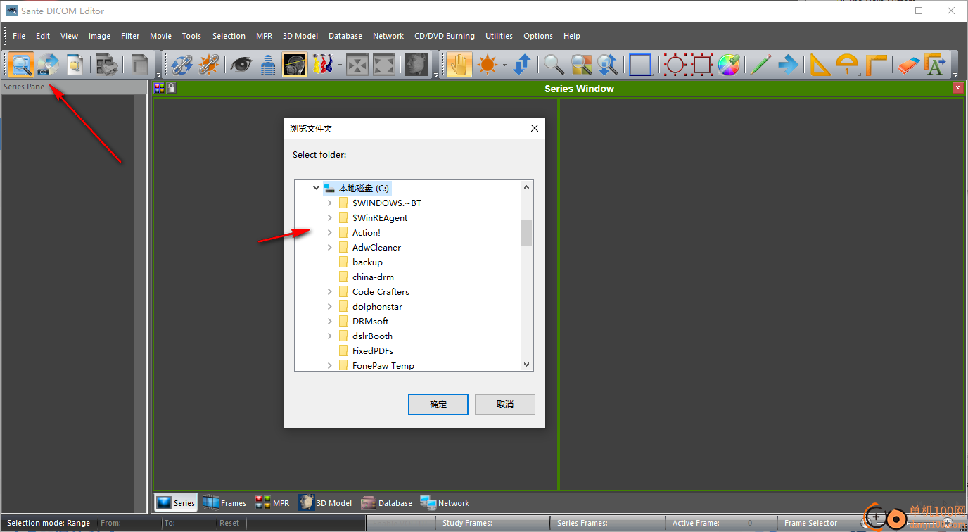 Sante DICOM Editor(医学影像编辑器)