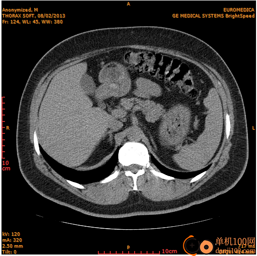 Sante DICOM Editor(医学影像编辑器)
