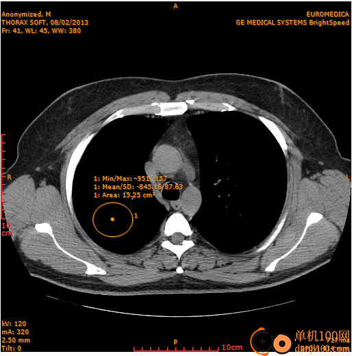 Sante DICOM Editor(医学影像编辑器)