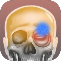 肌肉激痛点图谱免费版 v1.2