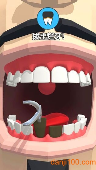 拔牙大师游戏(Dentist Bling)(1)