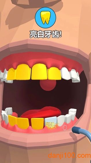 拔牙大师游戏(Dentist Bling)(3)
