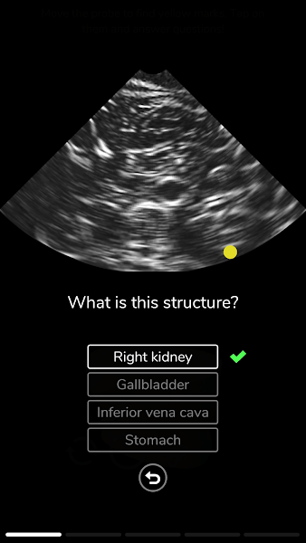 医用超声模拟器app(Deepscope Ultrasound Simulator)(2)