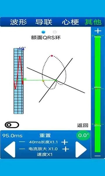 心电图计算器软件(4)