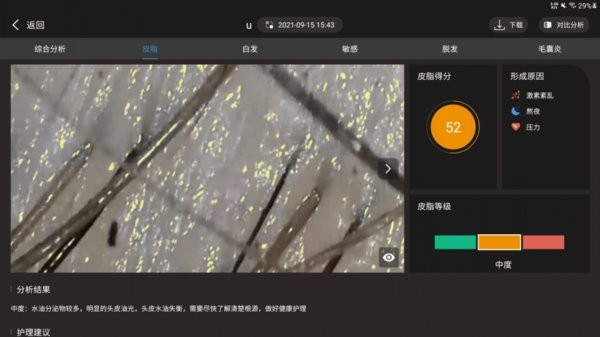 mayfurce毛囊检测appv3.9 安卓版 2