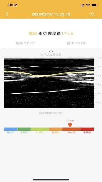 肌脂仪(marvoto脂肪厚度仪app)(3)