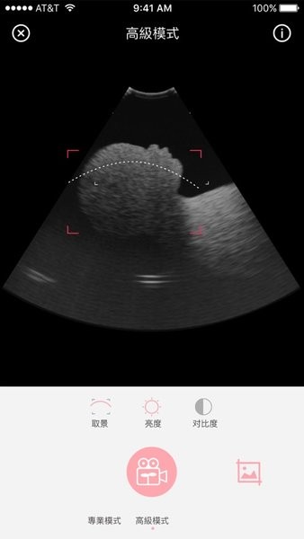 体内相机胎儿影像正版(Fetus Camera)(1)