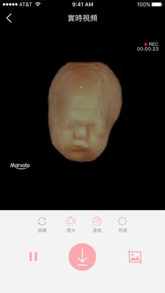 体内相机胎儿影像正版(Fetus Camera)v1.5.11 安卓版 4