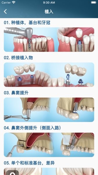 Dental IllustrationsApp