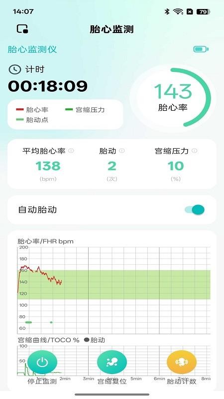 喜芽Pro手机版v2.0.5(2)
