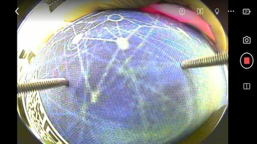 EndoThings手机版v1.0.15(2)