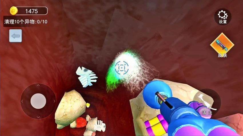 清理大肠达人手游v1.0 4