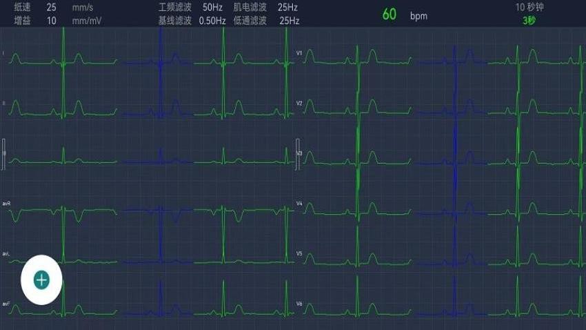 测心电商业版最新版v4.0.42(1)