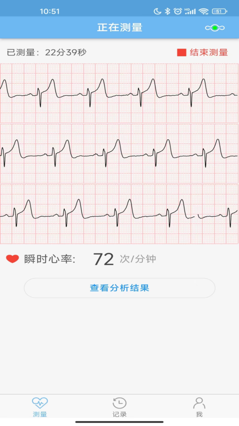 数维康心电手机版v1.9.93.0(3)
