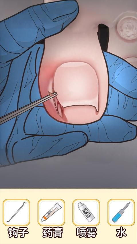 沉浸清理口腔手游v1.0 4