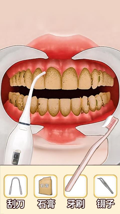 沉浸清理口腔手游v1.0 1