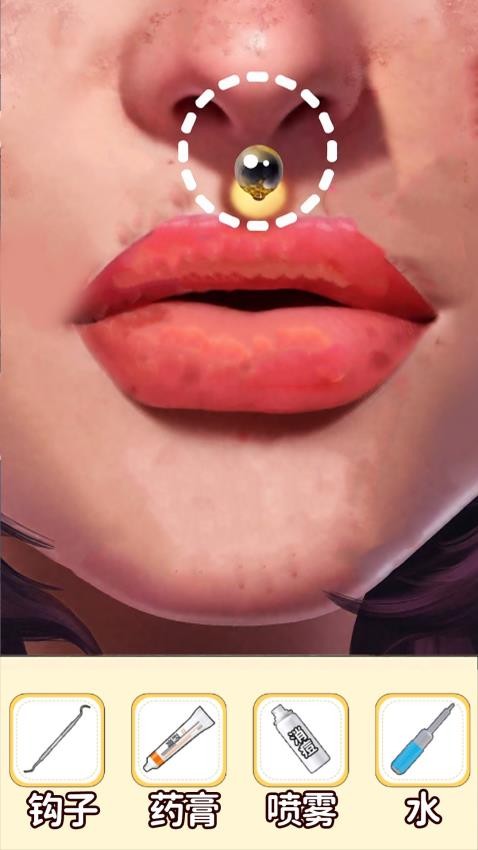 沉浸清理口腔手游v1.0 3